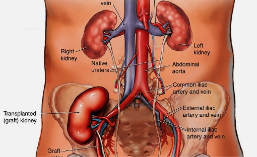 Kidney Transplant Procedure