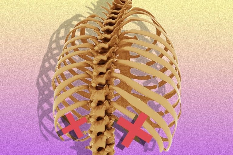 Rib Removal Surgery Cost, Importance and Risks Sutured