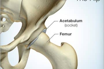 types of hip surgery