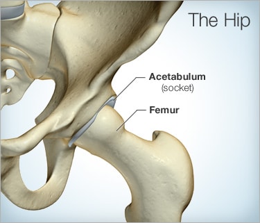 types of hip surgery