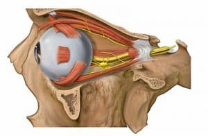 eye muscle surgery