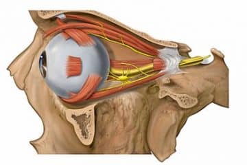 eye muscle surgery