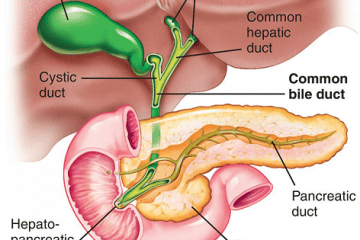 gallbladder removal cost
