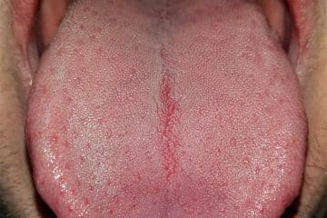 human tongue