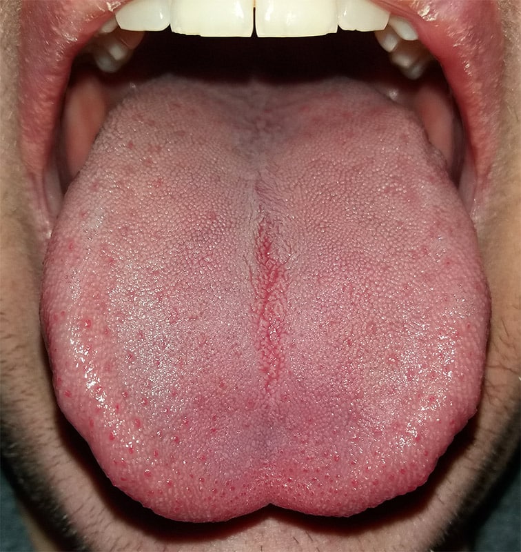 human tongue