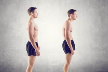 Causes of Postural Defects