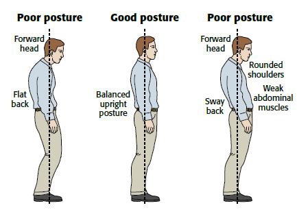 Causes of Postural Defects