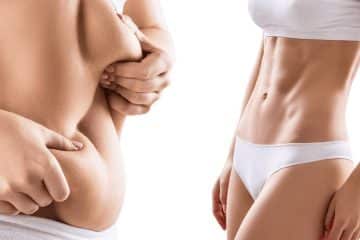Mommy Makeover Surgery Cost