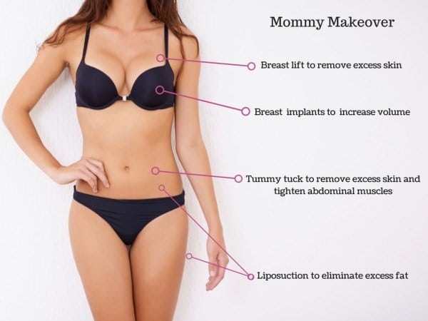 Mommy Makeover Surgery Cost - What is Mommy Makeover
