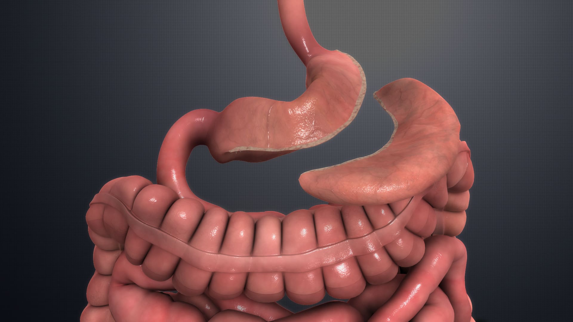 What Is Sleeve Gastrectomy Sutured what-is-sleeve-gastrectomy-sutured