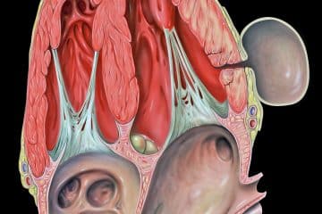 What is Chronic Pancreatitis