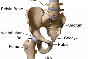 Hip Joint Surgery