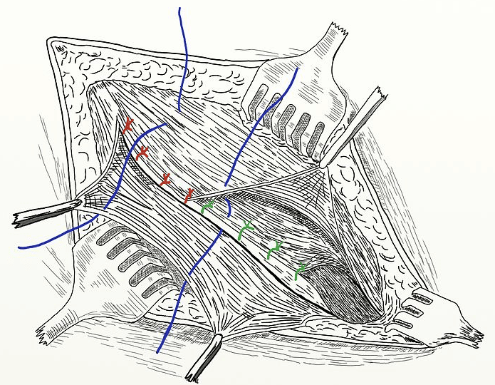 Emergency Hernia Surgery