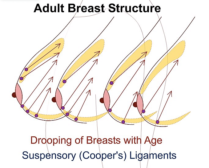 What to Expect After Breast Implant Removal