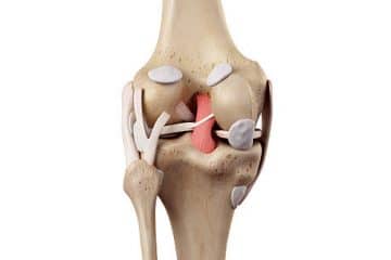 Tommy John Surgery