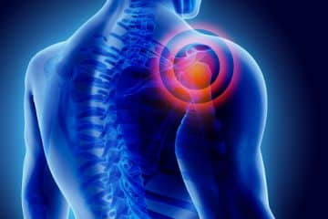 Total Shoulder Replacement