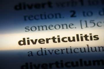 Perforated Diverticulitis Surgery